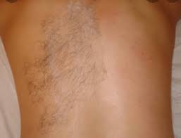 Back & Shoulders Manscape